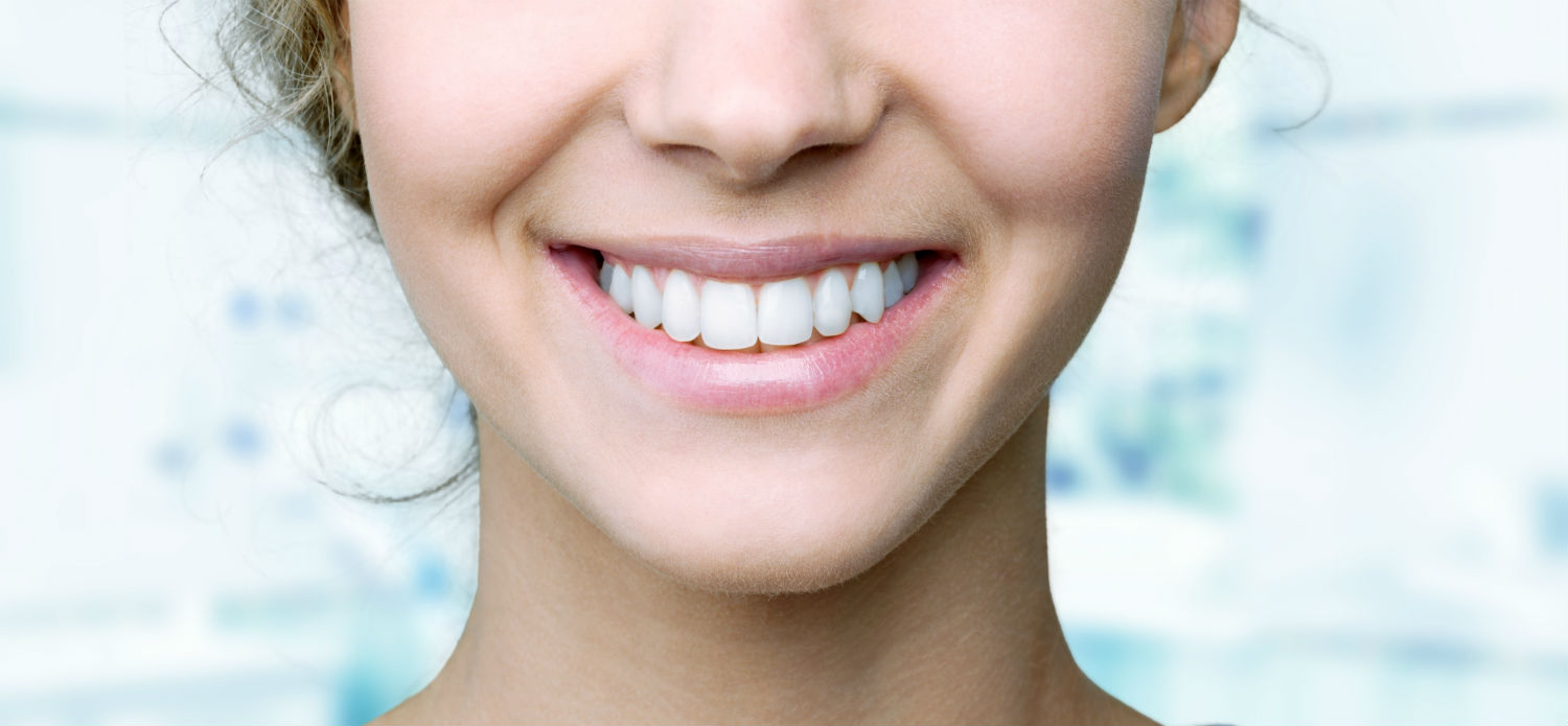An example of teeth after whitening.